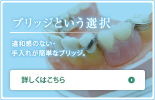 ブリッジという選択 違和感のない・ 手入れが簡単なブリッジ。 詳しくはこちら